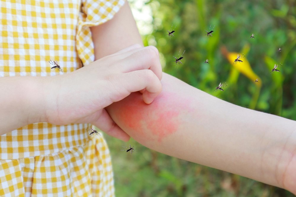 A girl in yellow dress scratching her arms from hives rash
